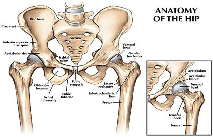Hip Replacement