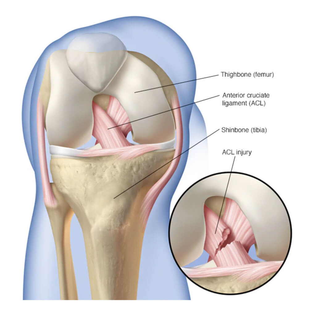 Best Knee Arthroscopy Doctor In Raipur | Dr. Saurabh Khare