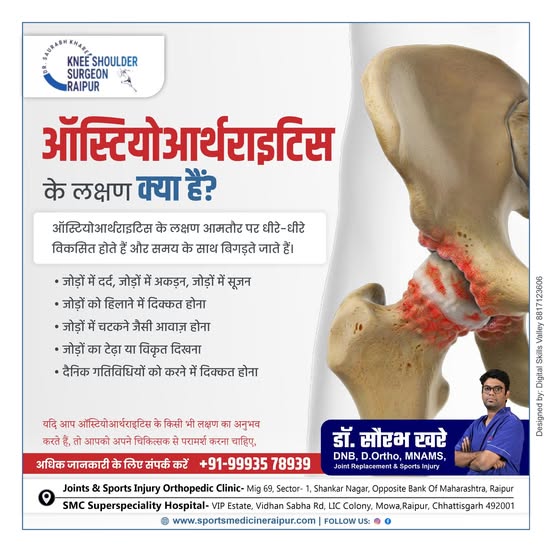 Osteoarthritis is one of the most common joint disorders, affecting millions of people worldwide.